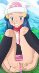 anal_beads blush bracelet clitoris clothed dawn hikari_(pokemon) no_panties outside pokemon presenting pussy smile spread_pussy sweat tkor tkor_(artist) uncensored