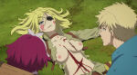 2_girls alicia_glenfall blonde_hair blood blue_eyes clevatess:_majuu_no_ou_to_akago_to_shikabane_no_yuusha closed_eyes edit eyepatch lying_on_grass medium_breasts medium_hair multicolored_hair nekom14 nipples no_bra scar_across_eye scar_on_chest scar_on_face screencap torn_clothes